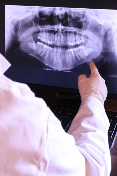 Best Emergency Dental Care for Sports Injuries in Millport, AL